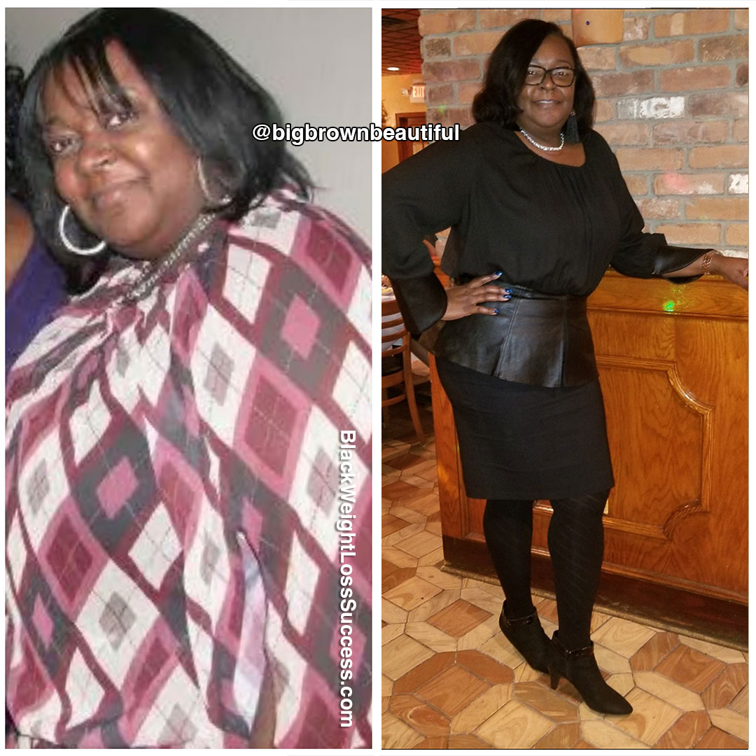 Shirele before and after weight loss