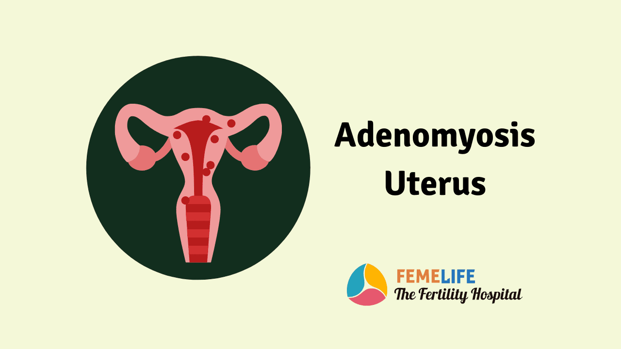 Adenomyosis Uterus: Facts to Know