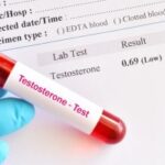 Abnormal low testosterone hormone test result