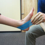 Taping for Posterior Tibialis Tendon Dysfunction (PTTD)