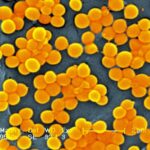 Nearly 40 million people could die from antibiotic-resistant superbug infections by 2050, new study estimates