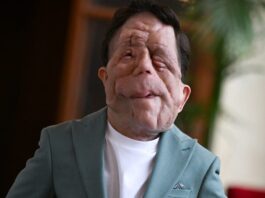 Adam Pearson knows he's 'A Different Man.' He wants to talk about it.